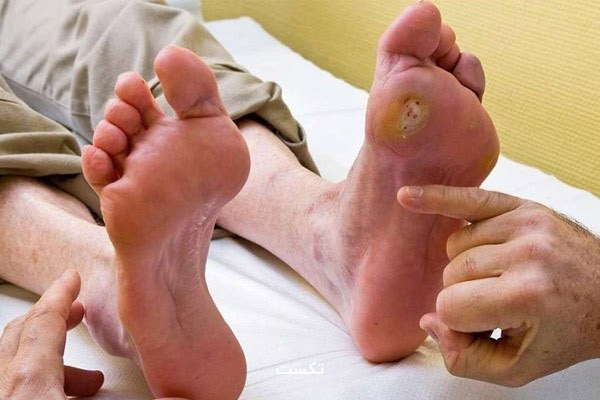 معاینه بالینی زخم پای دیابتی