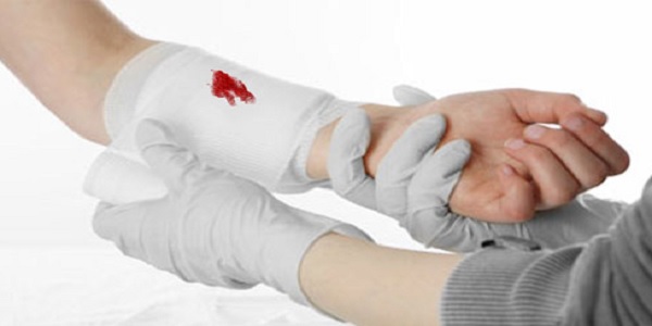 کنترل اولیه خونریزی