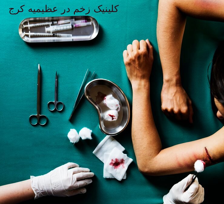کلینیک زخم در عظیمیه کرج